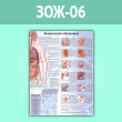 Плакат «Венерические заболевания» (ЗОЖ-06, ламинированная бумага, A2, 1 лист)